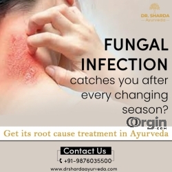 Fungal infection Ayurvedic treatment @ Dr Sharda Ayurveda Clinic
