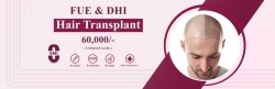 Best hair transplantation in Hyderabad