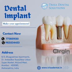 Dental Implants only within 2 days | Trisa Dental Solutions 