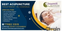 Acupuncture Treatment in Chennai - Acupuncturist Near Me 